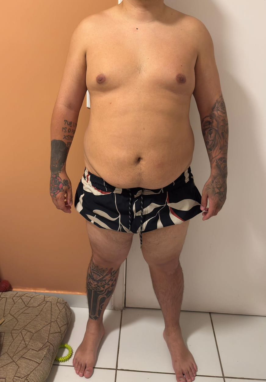Paciente antes do acompanhamento
