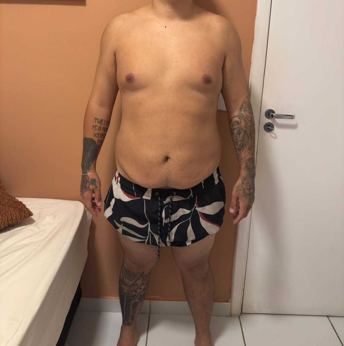 Paciente depois do acompanhamento